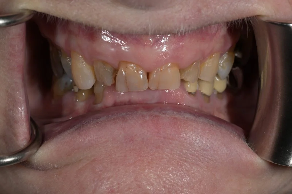 cosmetic dentist in harrogate