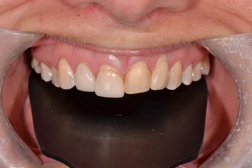 cosmetic dentist near harrogate