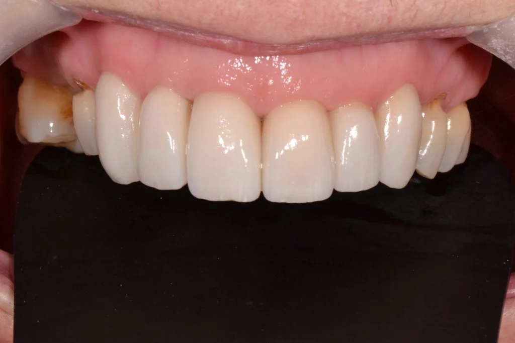 cosmetic dentistry harrogate