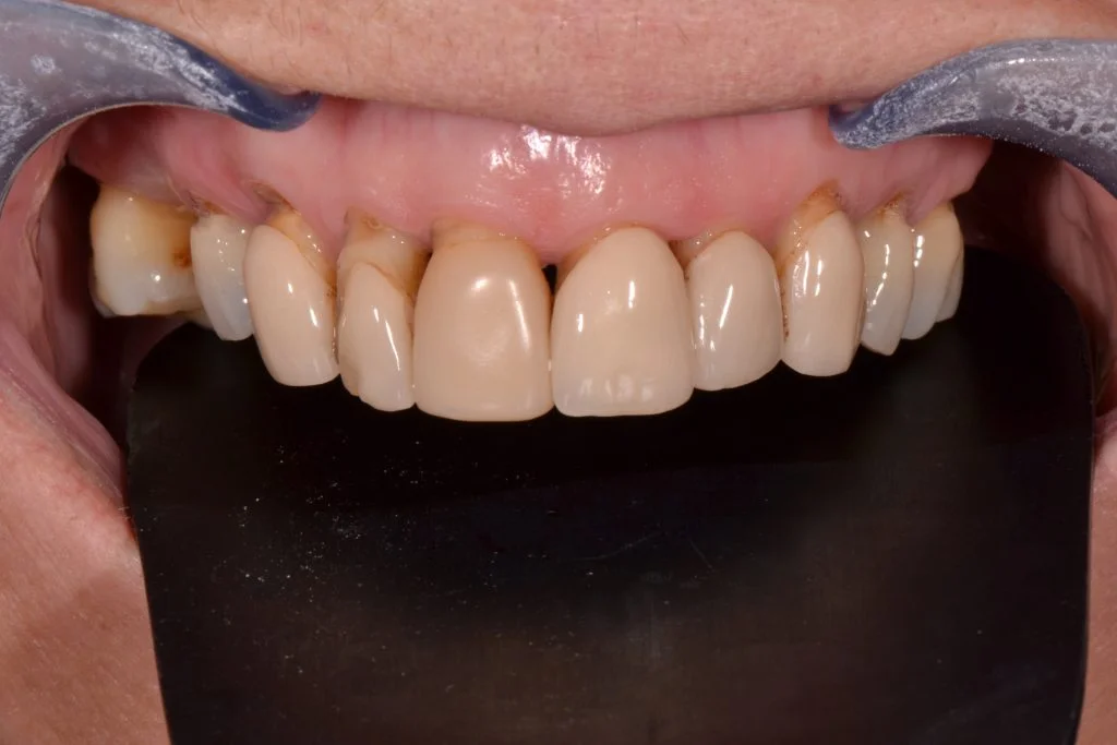 cosmetic dentistry in harrogate
