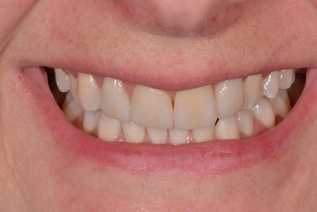 cosmetic dentistry near harrogate