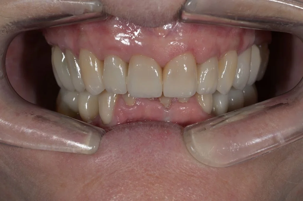 arrogate cosmetic dentist