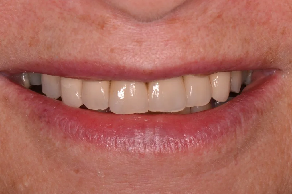 harrogate dental implant clinic