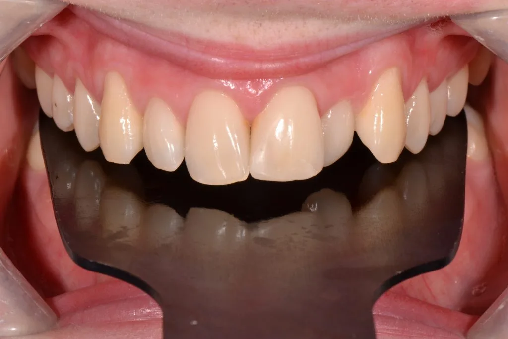 harrogate orthodonics