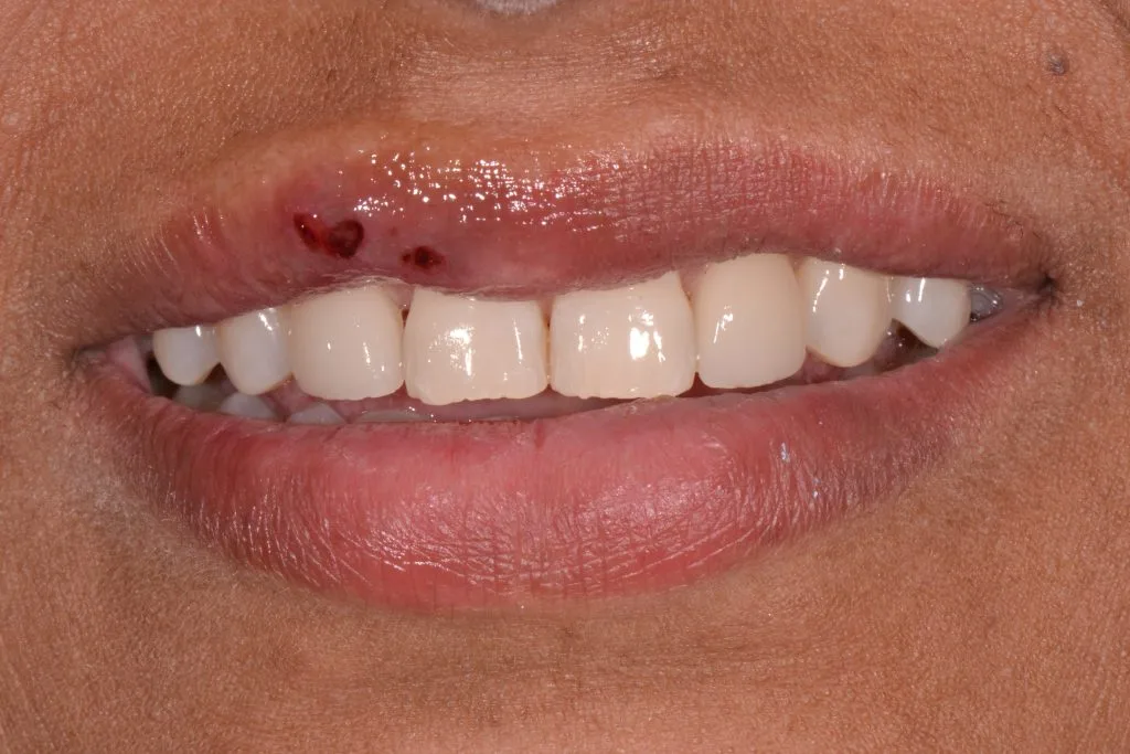 harrogate smile makeover after