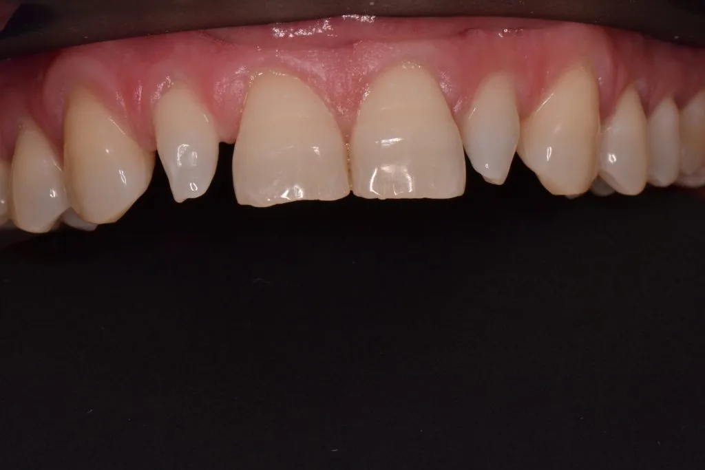 harrogate smile makeover