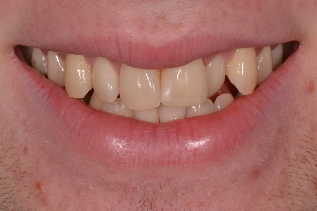 orthodontics harrogate