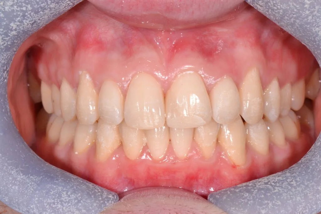 orthodontics in harrogate