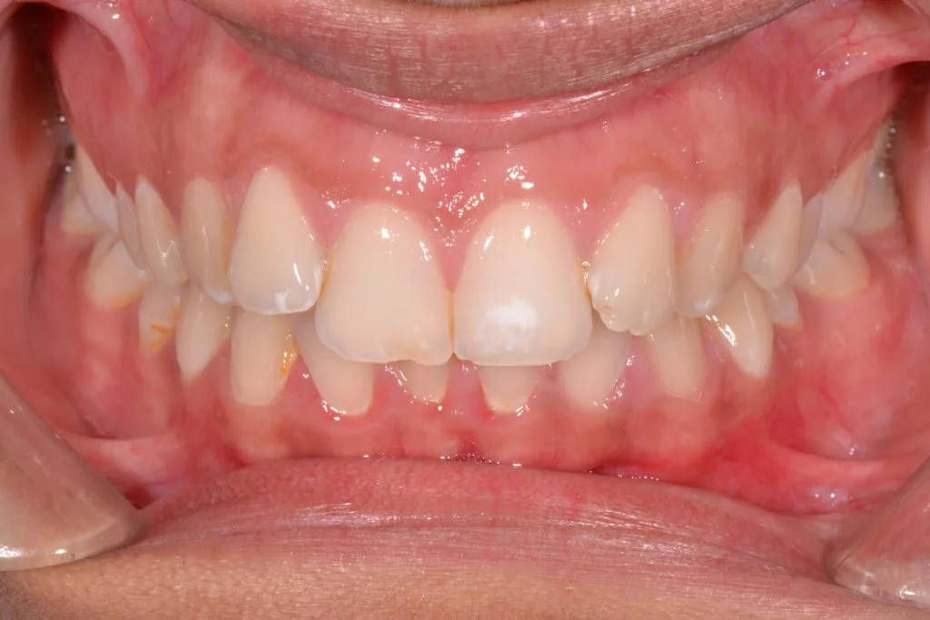 orthodontist harrogate