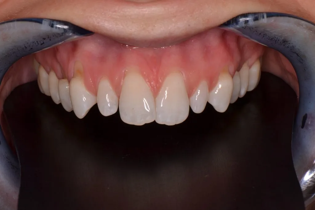 orthodontist near harrogate