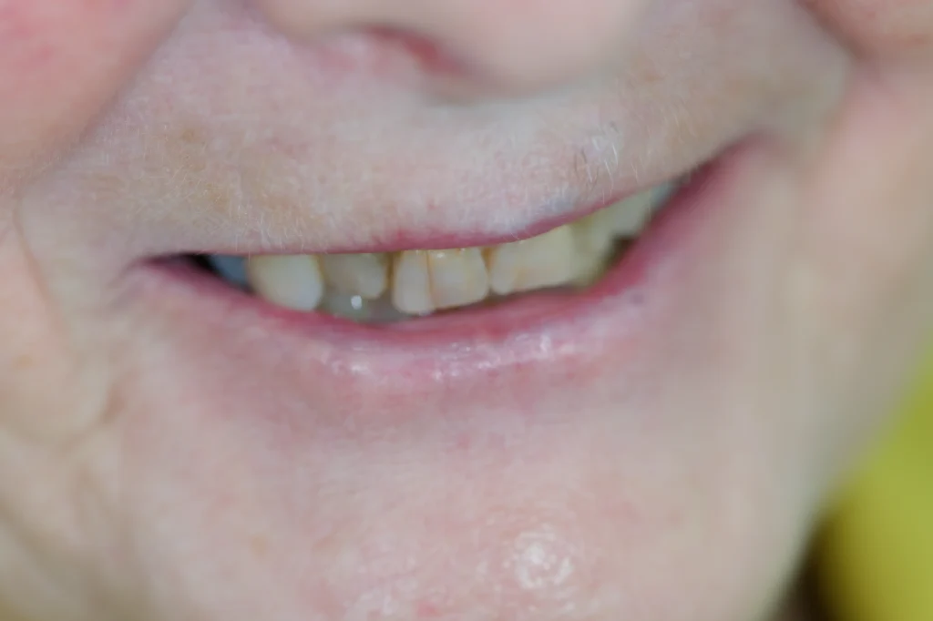 smile makeover harrogate