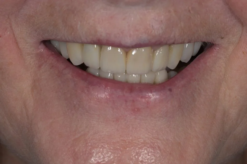 smile makeover in harrogate