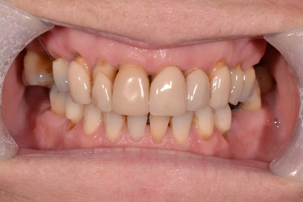 smile makeover treatment harrogate