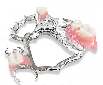 chrome dentures harrogate