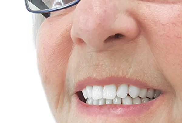 dentures in harrogate